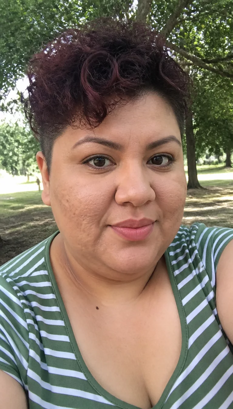 selfie of a 33-year-old plus size Latina woman with a chubby face and a delicate, straight nose. The skin is heavily textured with a complex pattern of acne pitting on the cheeks and a small mole on the neck. The eyes are dark and expressive. She is wearing a green and white striped top with a short curly dark auburn pixie cut with an undercut, front view, park background.
